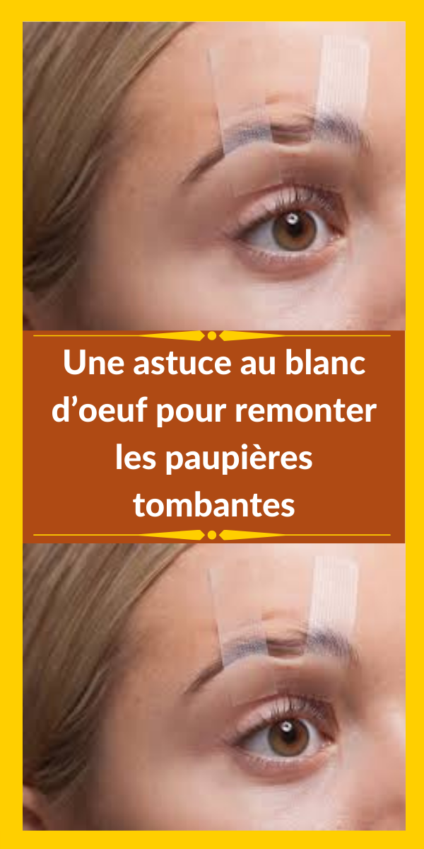 Remède naturel paupières gonflées