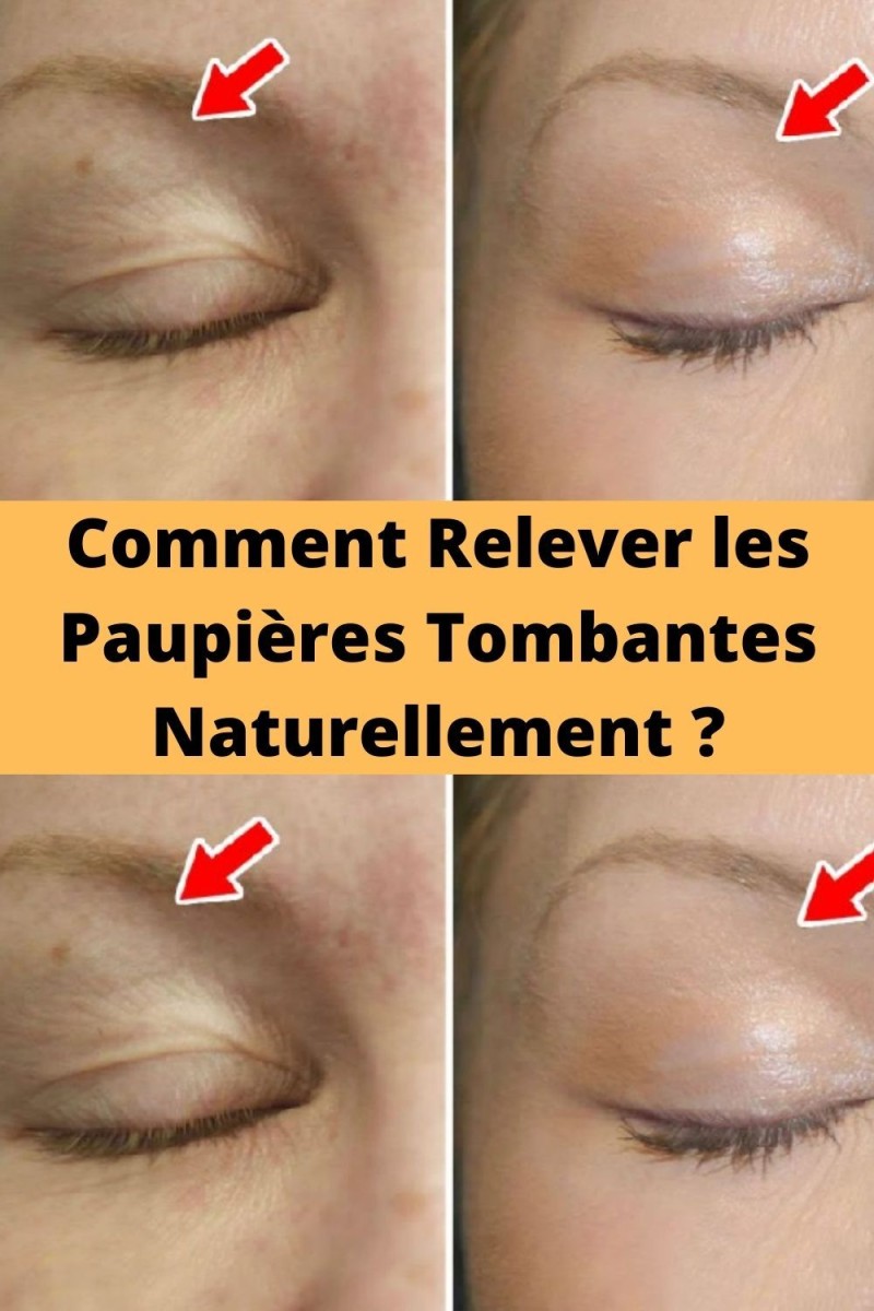 Remède naturel paupières gonflées