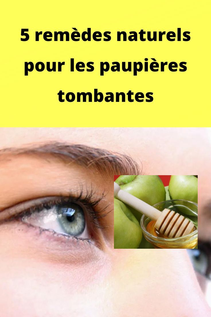 Remède naturel paupières gonflées