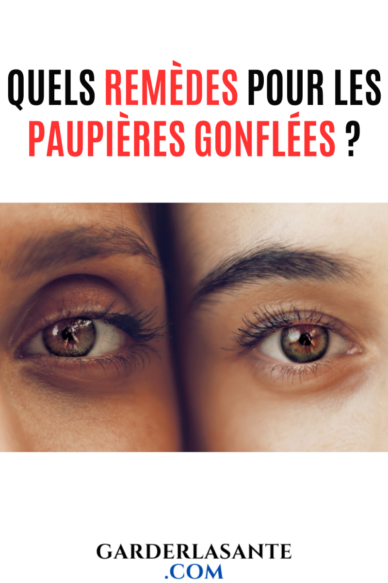 Paupières enflées